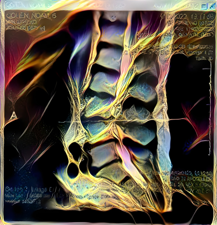 My Spine MRI
